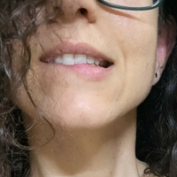 peste_mora Desnuda