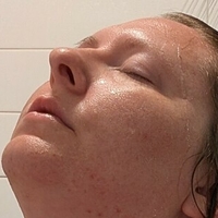 titlaser Desnuda